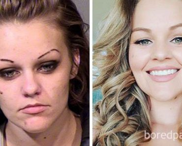 20 Ennen ja jälkeen kuvaa ihmisistä, jotka ovat päässeet irti huumeista