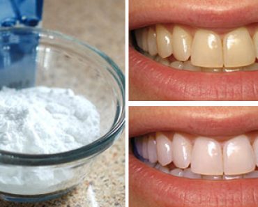 Korvaa hammastahna tällä aineella ja saat hohtavan valkoiset hampaat