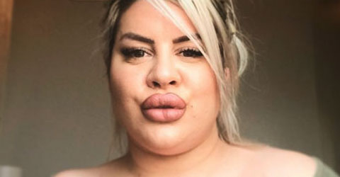 Naisen unelma on saada maailman suurin takapuoli – Katso hurjat kuvat