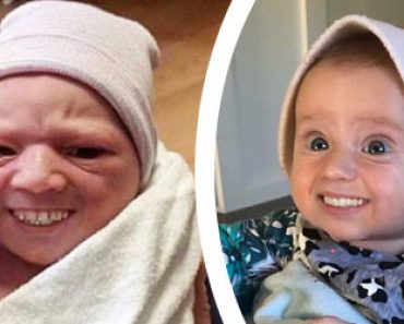 Vauvoille photoshopattiin aikuisten hampaat – kuvat järkyttävät katsojaa – Katso!